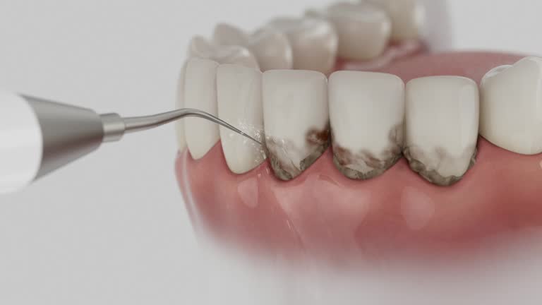 Trusted Dental Crowns And Bridges service in Endicott, NY - Dentist Open Now